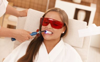 Over the Counter and Natural Whitening vs Professional Tooth Whitening in Albion