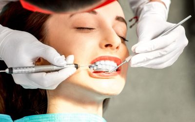 Do You Really Need Regular Dental Cleanings in Albion?