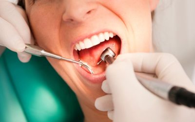 Why Do You Need a Dental Exam and Cleaning Every Six Months?