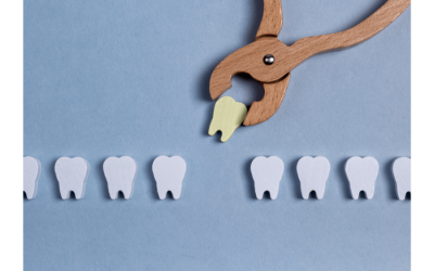 Patience and Healing: Navigating Wisdom Teeth Extraction Recovery Time