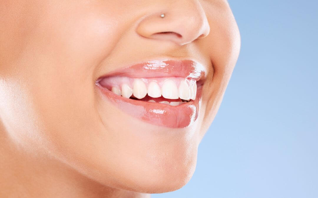 What Can Cosmetic Dentistry in Albion, NY, Help With