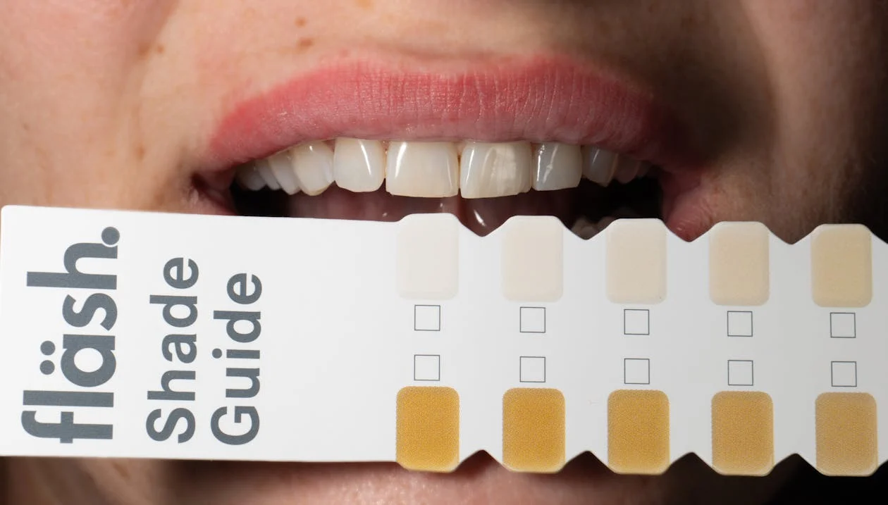 Tooth Whitening in Albion