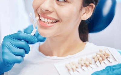 Are Veneers in Albion Permanent? What You Need to Know Before Getting Them