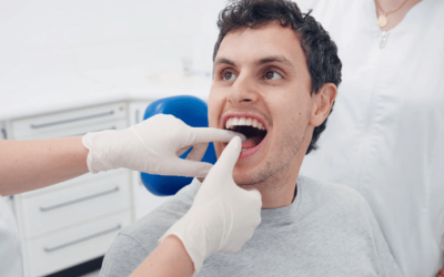 Mouthguards in Albion: How They Prevent Dental Emergencies
